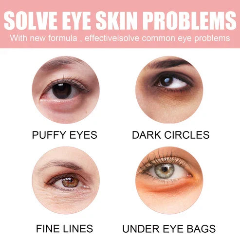 Fading Wrinkle Eye Bag Care
